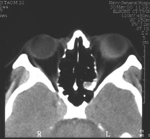 Image3.jpg (15504 �ֽ�)