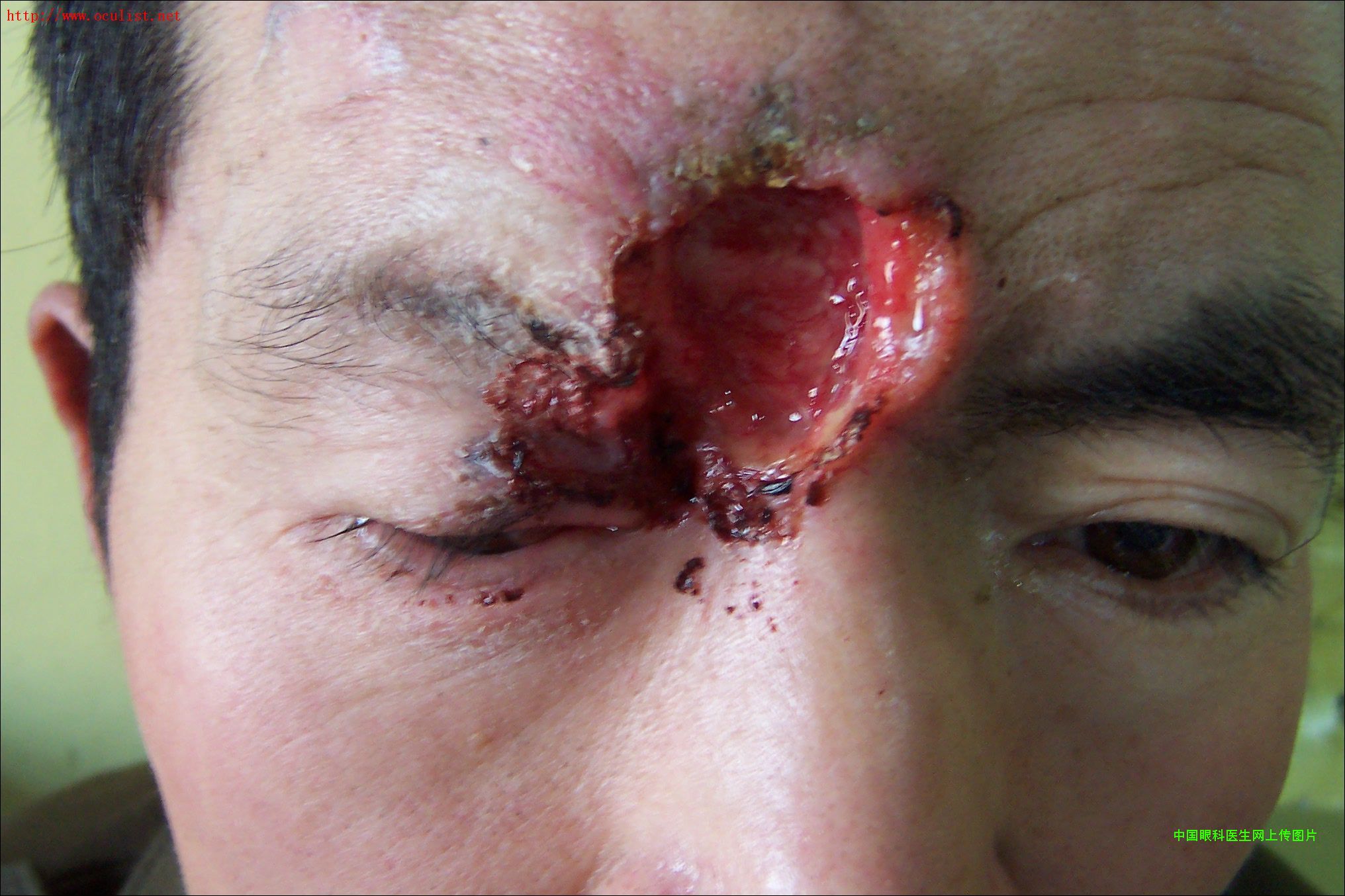 ͼƬ��������´��ڴ򿪲鿴