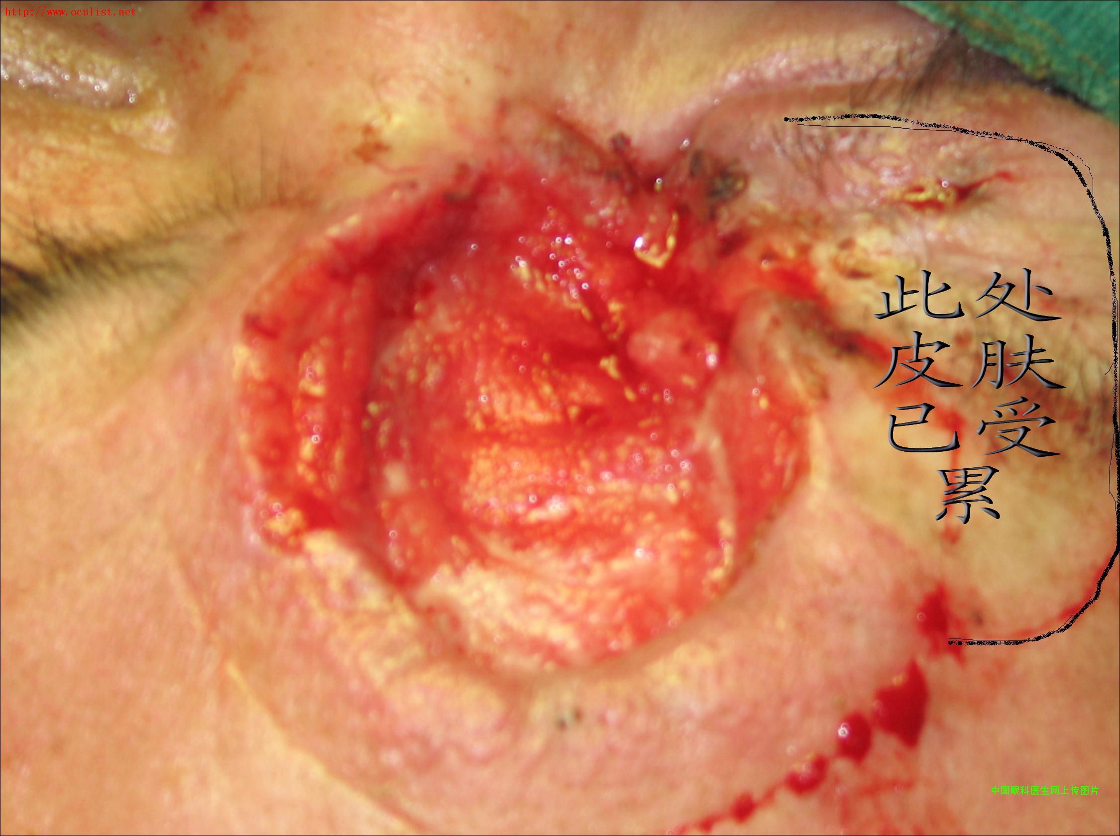 ͼƬ��������´��ڴ򿪲鿴