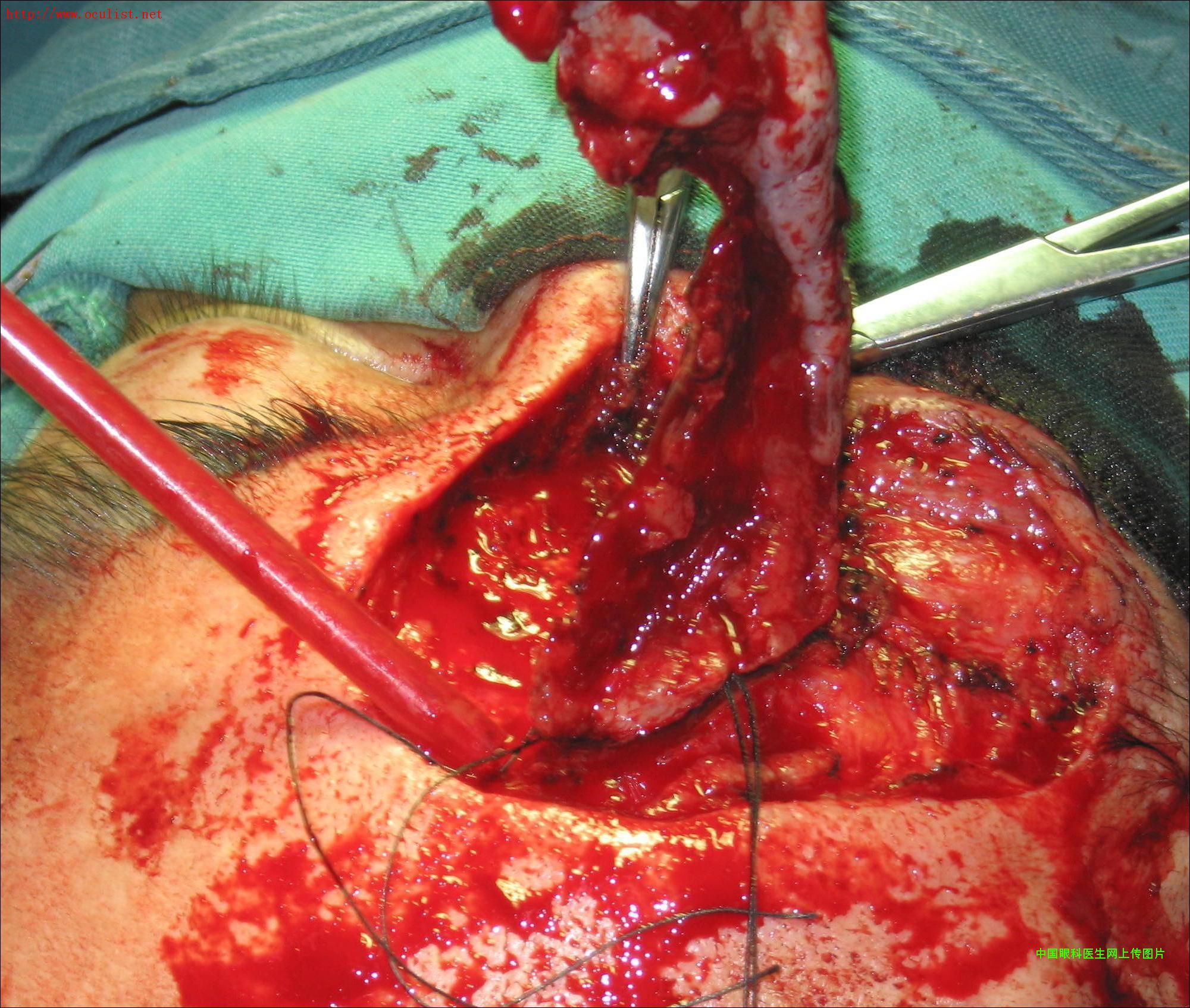 ͼƬ��������´��ڴ򿪲鿴