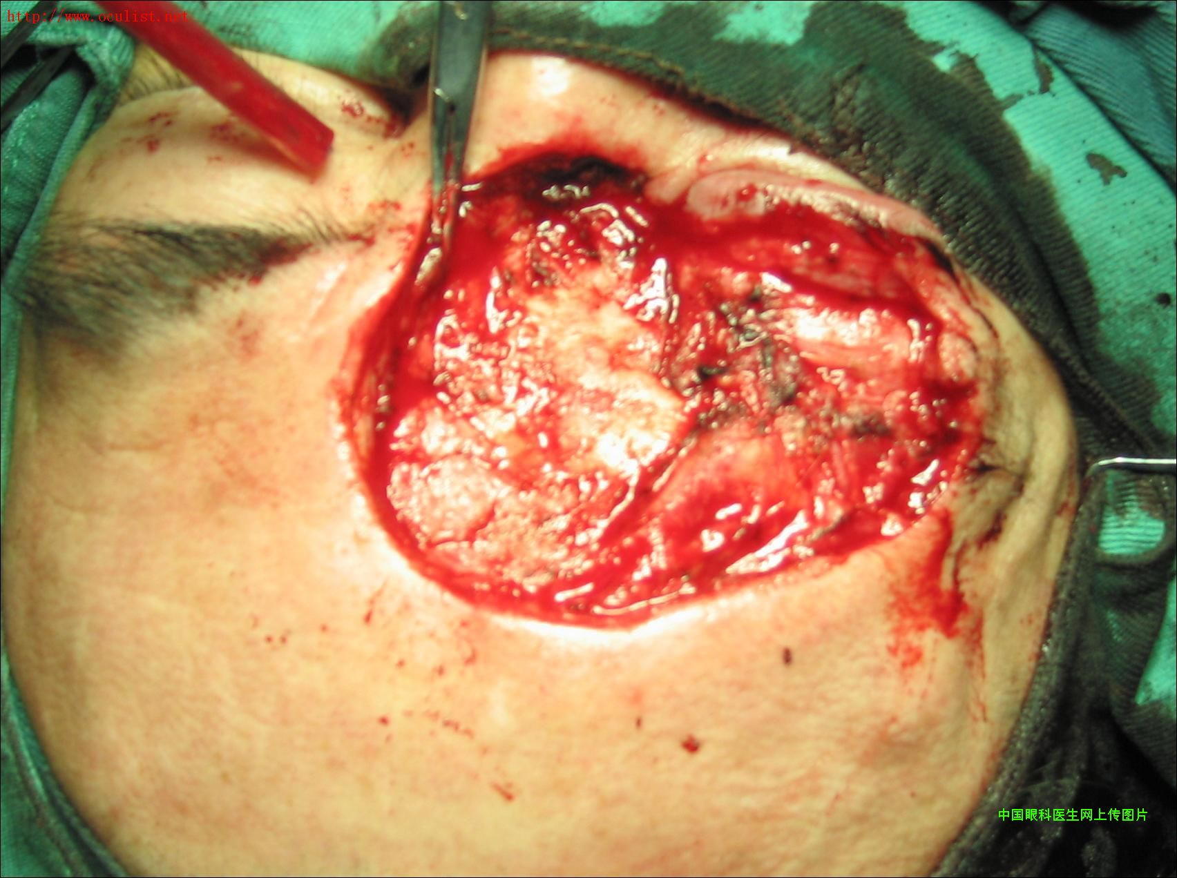 ͼƬ��������´��ڴ򿪲鿴