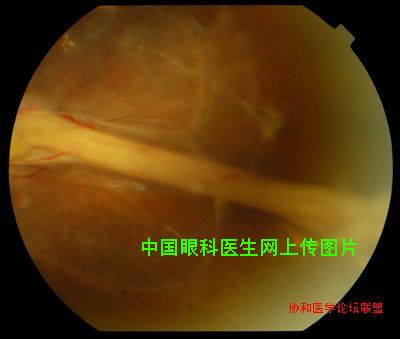 图片点击可在新窗口打开查看