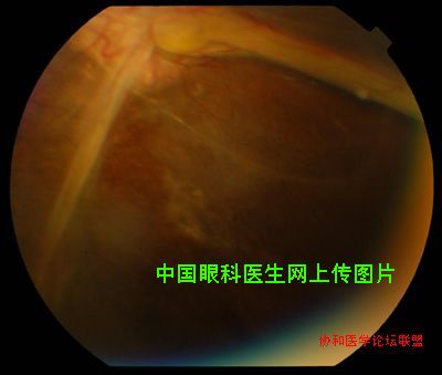 图片点击可在新窗口打开查看