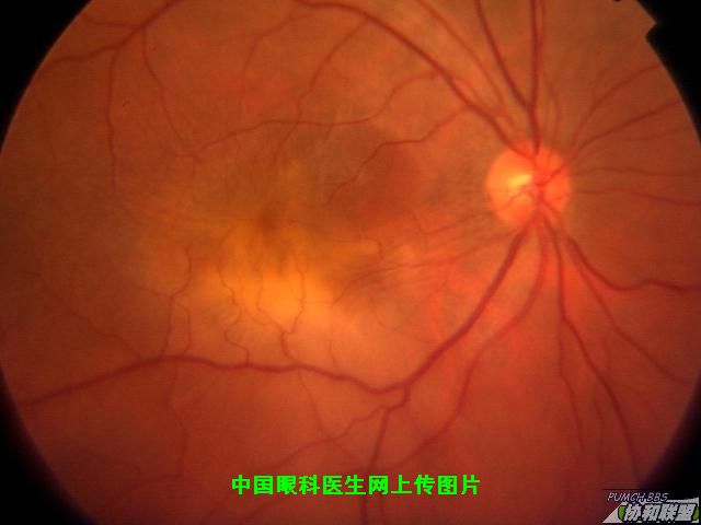 ͼƬ��������´��ڴ򿪲鿴