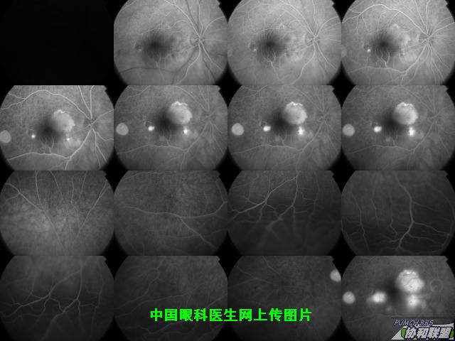 ͼƬ��������´��ڴ򿪲鿴