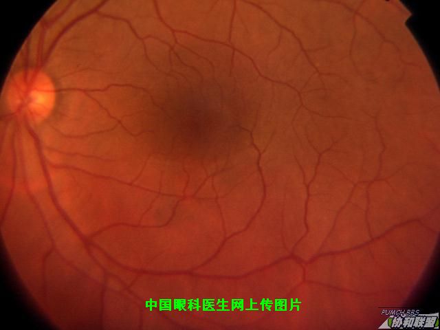 ͼƬ��������´��ڴ򿪲鿴