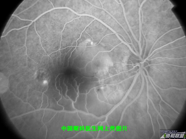 ͼƬ��������´��ڴ򿪲鿴