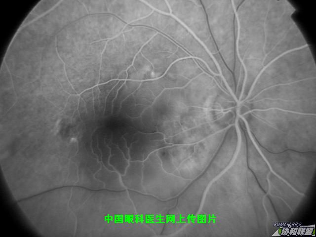 ͼƬ��������´��ڴ򿪲鿴