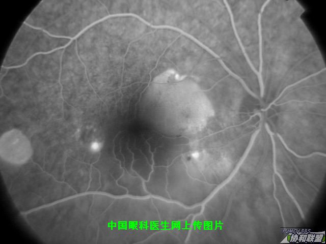 ͼƬ��������´��ڴ򿪲鿴