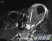 ͼƬ��������´��ڴ򿪲鿴