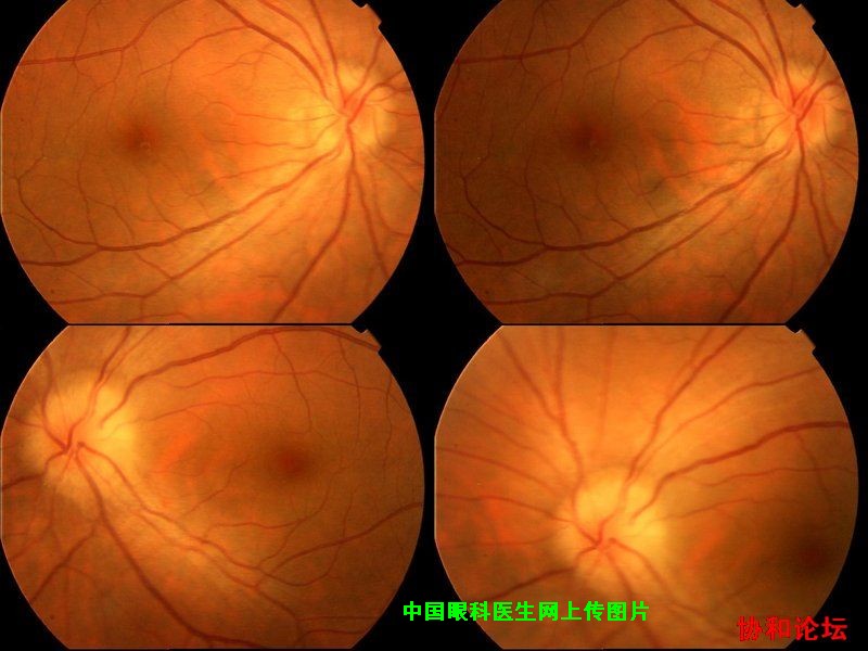 dvubb 图片点击可在新窗口打开查看