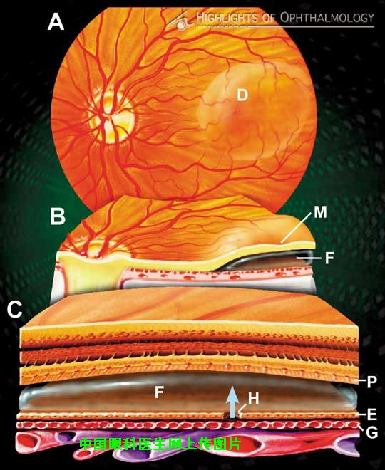 �н����������Ĥģʽͼ